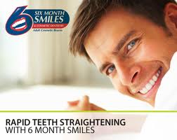 Six Month Smiles Six Month Smiles
