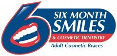 Six Month Smiles Six month Smiles