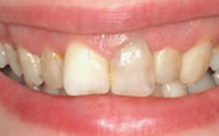 case1 before
